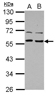 TOM1L1 Antibody - Sample (30 ug of whole cell lysate) A: A431 B: HeLa 10% SDS PAGE TOM1L1 antibody diluted at 1:1000
