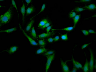 TOM1L1 Antibody - Immunofluorescence staining of Hela cells at a dilution of 1:105, counter-stained with DAPI. The cells were fixed in 4% formaldehyde, permeabilized using 0.2% Triton X-100 and blocked in 10% normal Goat Serum. The cells were then incubated with the antibody overnight at 4 °C.The secondary antibody was Alexa Fluor 488-congugated AffiniPure Goat Anti-Rabbit IgG (H+L) .