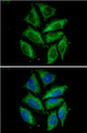TOMM20 Antibody - ICC/IF analysis of Tomm20 in HeLa cells. The cell was stained with Tomm20 antibody (1:100).The secondary antibody (green) was used Alexa Fluor 488. DAPI was stained the cell nucleus (blue).