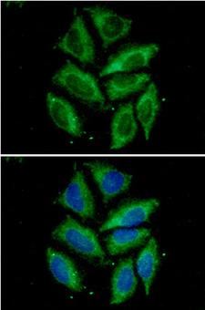 TOMM20 Antibody - ICC/IF analysis of Tomm20 in HeLa cells. The cell was stained with Tomm20 antibody (1:100).The secondary antibody (green) was used Alexa Fluor 488. DAPI was stained the cell nucleus (blue).
