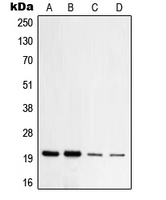 TOMM20 Antibody - Western blot analysis of TOM20 expression in HeLa (A); HepG2 (B); NIH3T3 (C); PC12 (D) whole cell lysates.