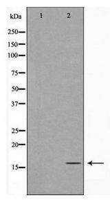 TOMM20 Antibody - Western blot of TOMM20 expression in K562 cells