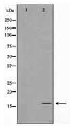 TOMM20 Antibody - Western blot of TOMM20 expression in K562 cells