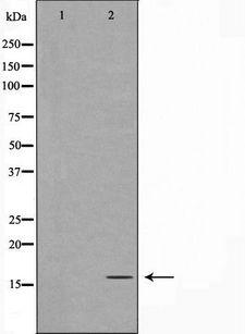 TOMM20 Antibody - Western blot analysis of TOMM20 expression in K562 cells. The lane on the left is treated with the antigen-specific peptide.