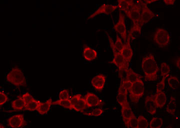 TOMM20 Antibody - Staining HeLa cells by IF/ICC. The samples were fixed with PFA and permeabilized in 0.1% Triton X-100, then blocked in 10% serum for 45 min at 25°C. The primary antibody was diluted at 1:200 and incubated with the sample for 1 hour at 37°C. An Alexa Fluor 594 conjugated goat anti-rabbit IgG (H+L) Ab, diluted at 1/600, was used as the secondary antibody.
