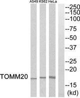 TOMM20 Antibody - Western blot analysis of extracts from HeLa cells, K562 cells and A549 cells, using TOMM20 antibody.