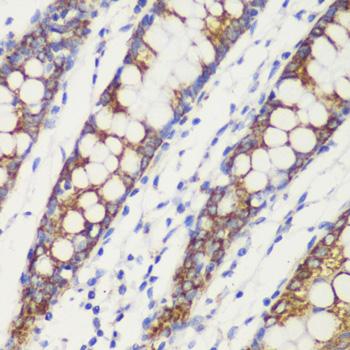 TOMM20 Antibody - Immunohistochemistry of paraffin-embedded Human colon using TOM20 Polyclonal Antibody at dilution of 1:100 (40x lens).