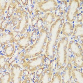 TOMM20 Antibody - Immunohistochemistry of paraffin-embedded Mouse kidney using TOM20 Polyclonal Antibody at dilution of 1:100 (40x lens).