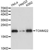TOMM22 / TOM22 Antibody - Western blot analysis of extracts of various cell lines, using TOMM22 antibody at 1:3000 dilution. The secondary antibody used was an HRP Goat Anti-Rabbit IgG (H+L) at 1:10000 dilution. Lysates were loaded 25ug per lane and 3% nonfat dry milk in TBST was used for blocking. An ECL Kit was used for detection and the exposure time was 10s.