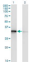 TOMM34 Antibody - Western blot of TOMM34 expression in transfected 293T cell line by TOMM34 monoclonal antibody (M02), clone 1D2.