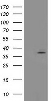TOMM34 Antibody - HEK293T cells were transfected with the pCMV6-ENTRY control (Left lane) or pCMV6-ENTRY TOMM34 (Right lane) cDNA for 48 hrs and lysed. Equivalent amounts of cell lysates (5 ug per lane) were separated by SDS-PAGE and immunoblotted with anti-TOMM34.