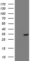 TOMM34 Antibody - HEK293T cells were transfected with the pCMV6-ENTRY control (Left lane) or pCMV6-ENTRY TOMM34 (Right lane) cDNA for 48 hrs and lysed. Equivalent amounts of cell lysates (5 ug per lane) were separated by SDS-PAGE and immunoblotted with anti-TOMM34.