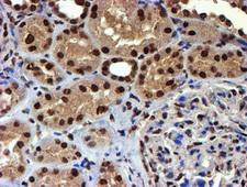 TOMM34 Antibody - IHC of paraffin-embedded Human Kidney tissue using anti-TOMM34 mouse monoclonal antibody.