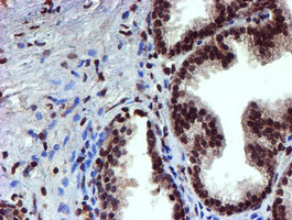 TOMM34 Antibody - IHC of paraffin-embedded Human prostate tissue using anti-TOMM34 mouse monoclonal antibody.