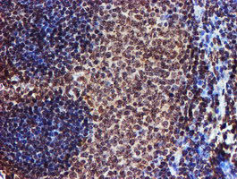 TOMM34 Antibody - IHC of paraffin-embedded Human tonsil using anti-TOMM34 mouse monoclonal antibody.