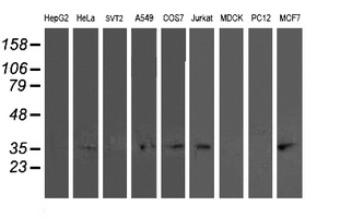 TOMM34 Antibody - Western blot of extracts (35 ug) from 9 different cell lines by using anti-TOMM34 monoclonal antibody.