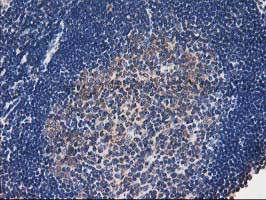 TOMM34 Antibody - IHC of paraffin-embedded Human lymph node tissue using anti-TOMM34 mouse monoclonal antibody.