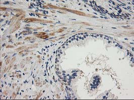 TOMM34 Antibody - IHC of paraffin-embedded Human prostate tissue using anti-TOMM34 mouse monoclonal antibody.