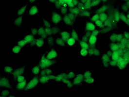 TOMM34 Antibody - Immunofluorescent staining of HeLa cells using anti-TOMM34 mouse monoclonal antibody.