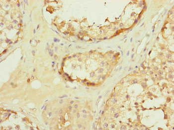 TOMM34 Antibody - Immunohistochemistry of paraffin-embedded human testis tissue at dilution of 1:100
