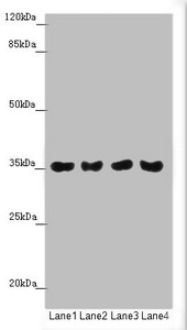 TOMM34 Antibody - Western blot All Lanes:TOMM34 antibody at 1.42 ug/ml Lane 1: Mouse gonadal tissue Lane 2: A549 whole cell lysate Lane 3: PC-3 whole cell lysate Lane 4: A375 whole cell lysate Secondary Goat polyclonal to rabbit IgG at 1/10000 dilution Predicted band size: 35 kDa Observed band size: 35 kDa