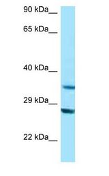 TOMM34 Antibody - TOMM34 antibody Western Blot of 721_B.  This image was taken for the unconjugated form of this product. Other forms have not been tested.