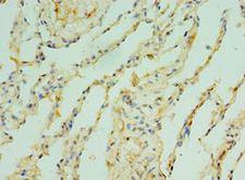 TOMM40 / TOM40 Antibody - Immunohistochemistry of paraffin-embedded human lung using antibody at 1:100 dilution.