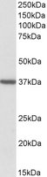 TOMM40 / TOM40 Antibody - TOMM40 antibody (2 ug/ml) staining of Human Frontal Cortex lysate (35 ug protein/ml in RIPA buffer). Primary incubation was 1 hour. Detected by chemiluminescence.