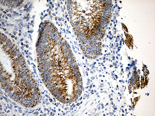 TOMM40 / TOM40 Antibody - Immunohistochemical staining of paraffin-embedded Human appendix tissue within the normal limits using anti-TOMM40 mouse monoclonal antibody. (Heat-induced epitope retrieval by 1mM EDTA in 10mM Tris buffer. (pH8.5) at 120°C for 3 min. (1:500)