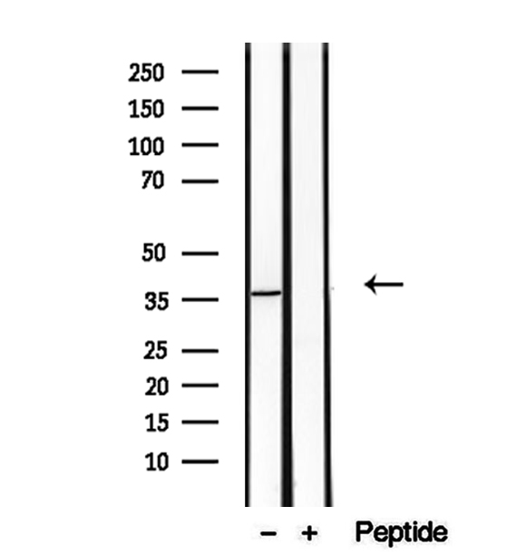 TOMM40 / TOM40 Antibody - Western blot analysis of extracts of A431 cells using TOM40 antibody.