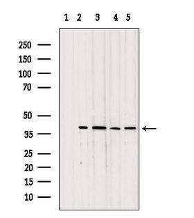 TOMM40 / TOM40 Antibody - Western blot analysis of extracts of various samples using TOM40 antibody. Lane 1: mouse myeloma treated with blocking peptide. Lane 2: mouse myeloma; Lane 3: B16F10; Lane 4: rat brain; Lane 5: mouse brain;