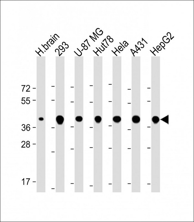 TOMM40 / TOM40 Antibody - All lanes: Anti-TOMM40 Antibody (N-Term) at 1:2000 dilution Lane 1: Human brain lysate Lane 2: 293 whole cell lysate Lane 3: U-87 MG whole cell lysate Lane 4: Hut78 whole cell lysate Lane 5: Hela whole cell lysate Lane 6: A431 whole cell lysate Lane 7: HepG2 whole cell lysate Lysates/proteins at 20 µg per lane. Secondary Goat Anti-Rabbit IgG, (H+L), Peroxidase conjugated at 1/10000 dilution. Predicted band size: 38 kDa Blocking/Dilution buffer: 5% NFDM/TBST.