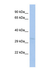 TOMM40L Antibody - TOMM40L antibody Western blot of HT1080 cell lysate. This image was taken for the unconjugated form of this product. Other forms have not been tested.