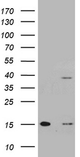 TOMM40L Antibody - HEK293T cells were transfected with the pCMV6-ENTRY control. (Left lane) or pCMV6-ENTRY TOMM40L. (Right lane) cDNA for 48 hrs and lysed. Equivalent amounts of cell lysates. (5 ug per lane) were separated by SDS-PAGE and immunoblotted with anti-TOMM40L. (1:500)