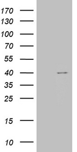 TOMM40L Antibody - HEK293T cells were transfected with the pCMV6-ENTRY control. (Left lane) or pCMV6-ENTRY TOMM40L. (Right lane) cDNA for 48 hrs and lysed. Equivalent amounts of cell lysates. (5 ug per lane) were separated by SDS-PAGE and immunoblotted with anti-TOMM40L. (1:500)