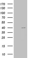 TOMM40L Antibody - HEK293T cells were transfected with the pCMV6-ENTRY control. (Left lane) or pCMV6-ENTRY TOMM40L. (Right lane) cDNA for 48 hrs and lysed