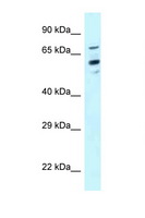 TOMM70A Antibody - TOMM70A antibody Western blot of HeLa Cell lysate. Antibody concentration 1 ug/ml.  This image was taken for the unconjugated form of this product. Other forms have not been tested.