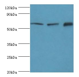 TOMM70A Antibody - Western blot. All lanes: TOMM70A antibody at 6 ug/ml. Lane 1: MCF-7 whole cell lysate. Lane 2: mouse liver tissue. Lane 3: mouse brain tissue. Secondary antibody: Goat polyclonal to rabbit at 1:10000 dilution. Predicted band size: 67 kDa. Observed band size: 67 kDa.