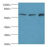 TOMM70A Antibody - Western blot. All lanes: TOMM70A antibody at 6 ug/ml. Lane 1: MCF-7 whole cell lysate. Lane 2: mouse liver tissue. Lane 3: mouse brain tissue. Secondary antibody: Goat polyclonal to rabbit at 1:10000 dilution. Predicted band size: 67 kDa. Observed band size: 67 kDa.