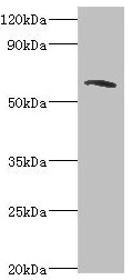 TOMM70A Antibody - Western blot All lanes: TOMM70A antibody at 6µg/ml + MCF-7 whole cell lysate Secondary Goat polyclonal to rabbit IgG at 1/10000 dilution Predicted band size: 67 kDa Observed band size: 67 kDa