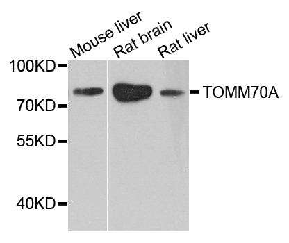 TOMM70A Antibody - Western blot analysis of extract of various cells.