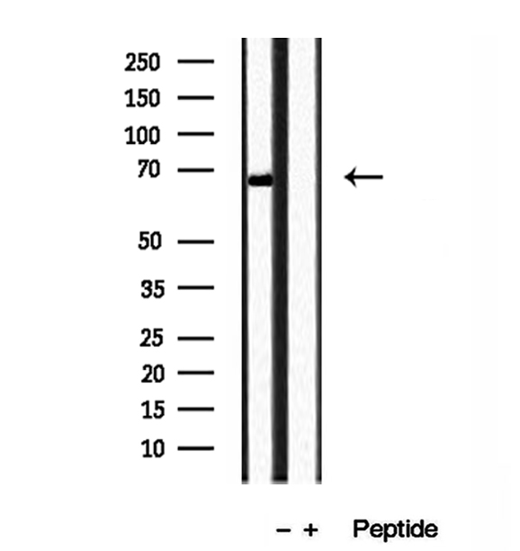 TOMM70A Antibody - Western blot analysis of extracts of mouse liver tissue using TOM70 antibody.
