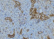 TOMM70A Antibody - 1:100 staining mouse kidney tissue by IHC-P. The sample was formaldehyde fixed and a heat mediated antigen retrieval step in citrate buffer was performed. The sample was then blocked and incubated with the antibody for 1.5 hours at 22°C. An HRP conjugated goat anti-rabbit antibody was used as the secondary.