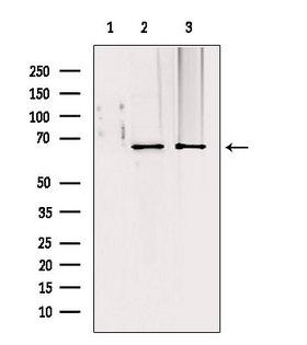TOMM70A Antibody - Western blot analysis of extracts of various samples using TOM70 antibody. Lane 1: HepG2 treated with blocking peptide. Lane 2: HepG2; Lane 3: 293;