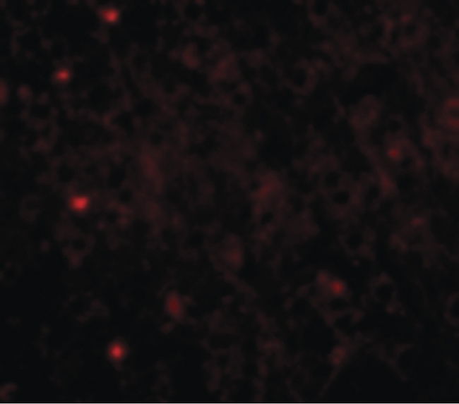 TOMM70A Antibody - Immunofluorescence of TOM70 in Mouse Brain cells with TOM70 antibody at 20 ug/ml.