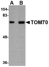 TOMM70A Antibody - Western blot of TOM70 in rat brain tissue lysate with TOM70 antibody at (A) 1 and (B) 2 ug/ml