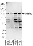 TONSL Antibody - Detection of Human NFKBIL2 by Western Blot. Samples: Whole cell lysate from 293T (15 and 50 ug), HeLa (H; 50 ug), and Jurkat (J; 50 ug) cells. Antibodies: Affinity purified rabbit anti-NFKBIL2 antibody used for WB at 0.4 ug/ml. Detection: Chemiluminescence with an exposure time of 3 minutes.