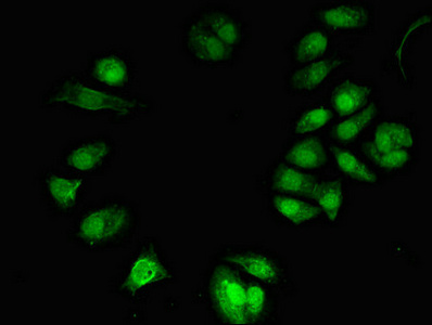 TONSL Antibody - Immunofluorescent analysis of MCF-7 cells diluted at 1:100 and Alexa Fluor 488-congugated AffiniPure Goat Anti-Rabbit IgG(H+L)
