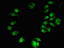 TONSL Antibody - Immunofluorescent analysis of MCF-7 cells diluted at 1:100 and Alexa Fluor 488-congugated AffiniPure Goat Anti-Rabbit IgG(H+L)