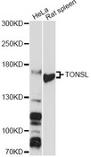 TONSL Antibody - Western blot analysis of extracts of various cell lines, using TONSL antibody at 1:3000 dilution. The secondary antibody used was an HRP Goat Anti-Rabbit IgG (H+L) at 1:10000 dilution. Lysates were loaded 25ug per lane and 3% nonfat dry milk in TBST was used for blocking. An ECL Kit was used for detection and the exposure time was 30s.